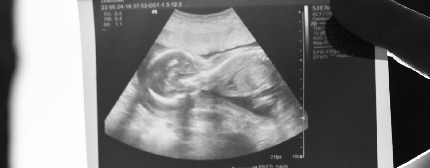 pexels-daniel-kondrashin-12721156