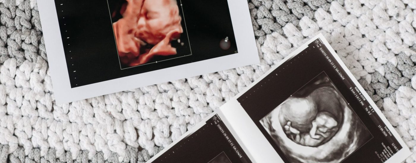 pexels-pavel-danilyuk-7055859